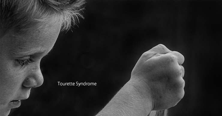 뚜렛증후군(Tourette Syndrome)의 원인과 증상, 치료법