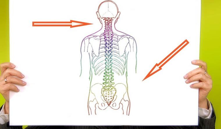 마르판 증후군이란? 증상, 원인, 그리고 치료법까지