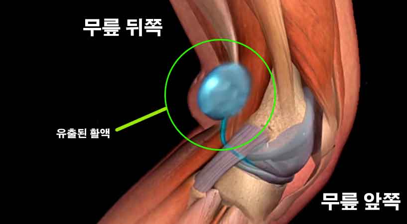 장염 중 피해야 할 음식들