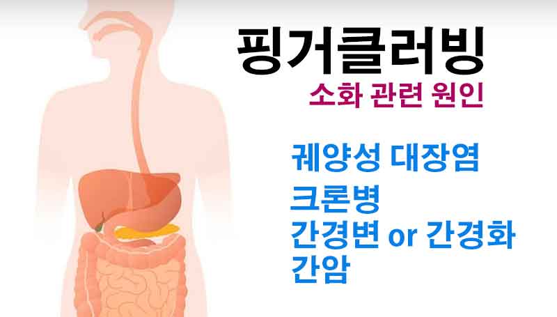 핑거클러빙의 원인과 증상, 핑거클러빙을 유발하는 질병들